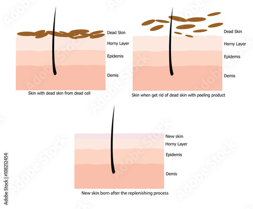 Skin replinished the new one after the peel the dead skin