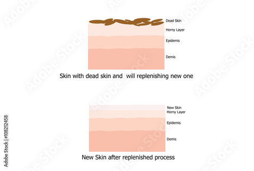 Skin replinished the new one after the peel the dead skin