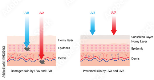 Skin compare between skin with spectrum-boarding sunscreen and n