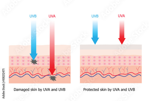 Skin compare between skin with spectrum-boarding sunscreen and n