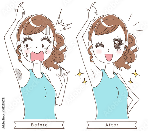 むだ毛ケアのイラスト