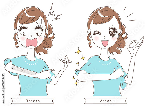 むだ毛ケアのイラスト
