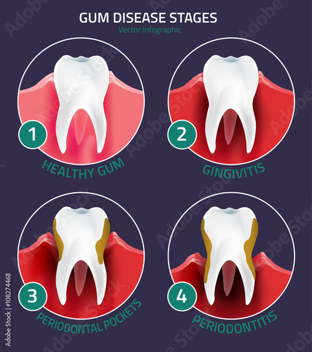 Teeth vector infographic