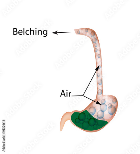 Belching. Air in the stomach. The structure of the esophagus and stomach. Infographics. Vector illustration