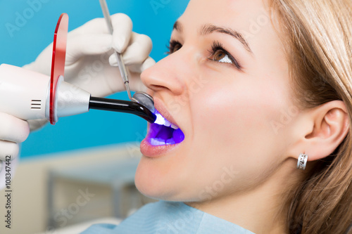 The reception was at the female dentist. Doctor examines the oral cavity on tooth decay. Caries protection. Tooth decay treatment. Dentist working with dental polymerization lamp in oral cavity
