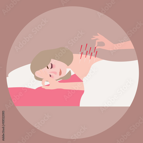 acupuncture woman therapy alternative treatment needle at her back vector illustration flat