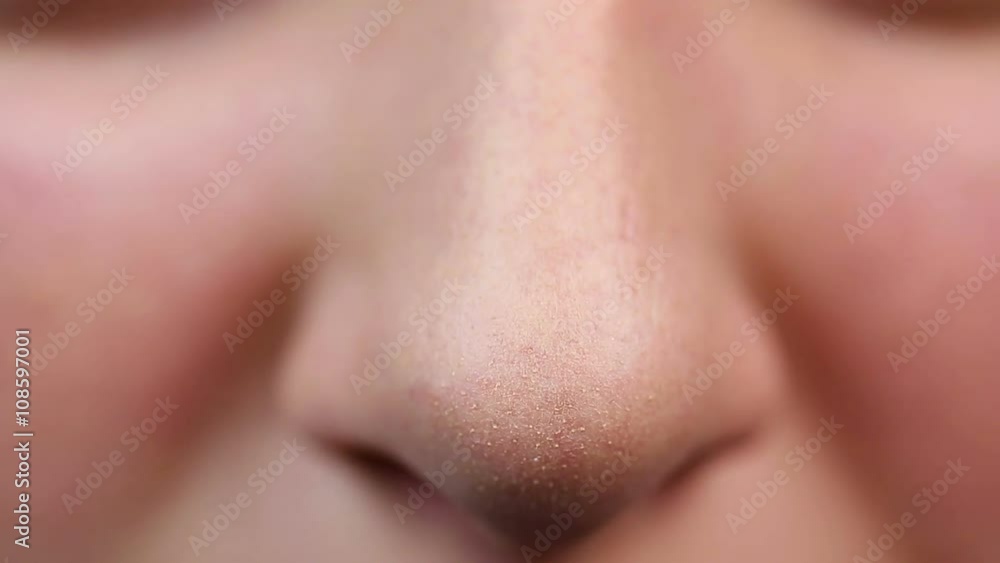 Closeup view of nose, reception at cosmetician. Enlarged pores, skin problems Closeup view of nose, reception at cosmetician. Enlarged pores, skin problems