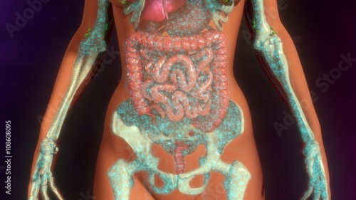 Schilderij op canvas Metastasis Infection