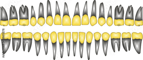 3D gold crown tooth