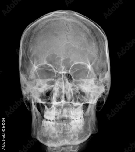 Obraz na płótnie skull x-rays image sagital plane