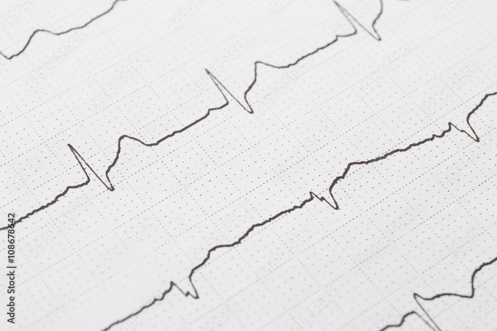 Close up of electrocardiogram chart background
