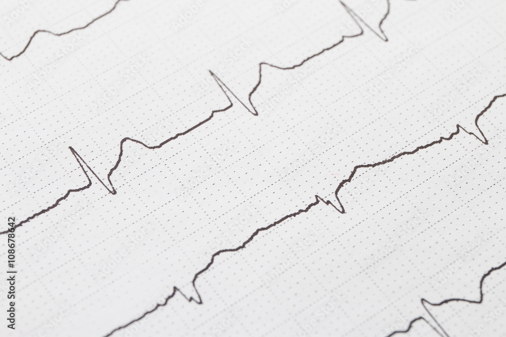 Close up of electrocardiogram chart background Close up of electrocardiogram chart background