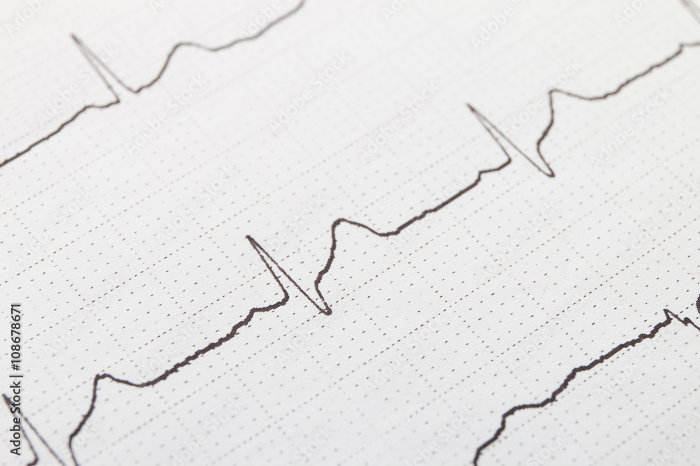 Close up of electrocardiogram chart background Close up of electrocardiogram chart background