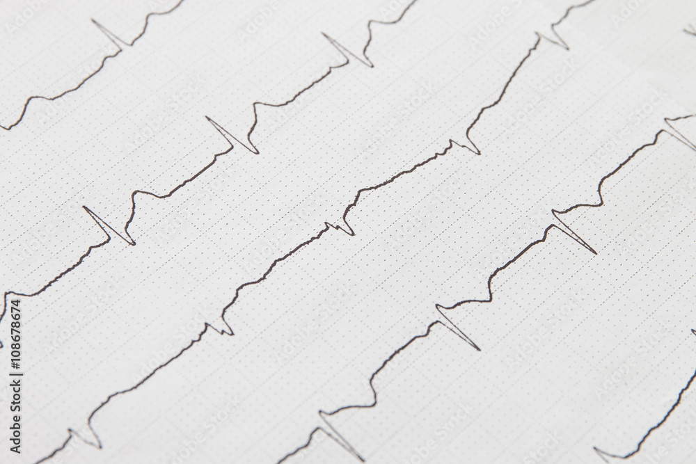 Close up of electrocardiogram chart background Close up of electrocardiogram chart background
