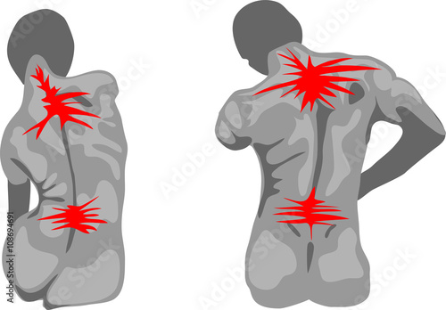 Painful female and male spine