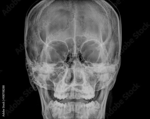 Tableau sur toile skull x-rays image sagital plane