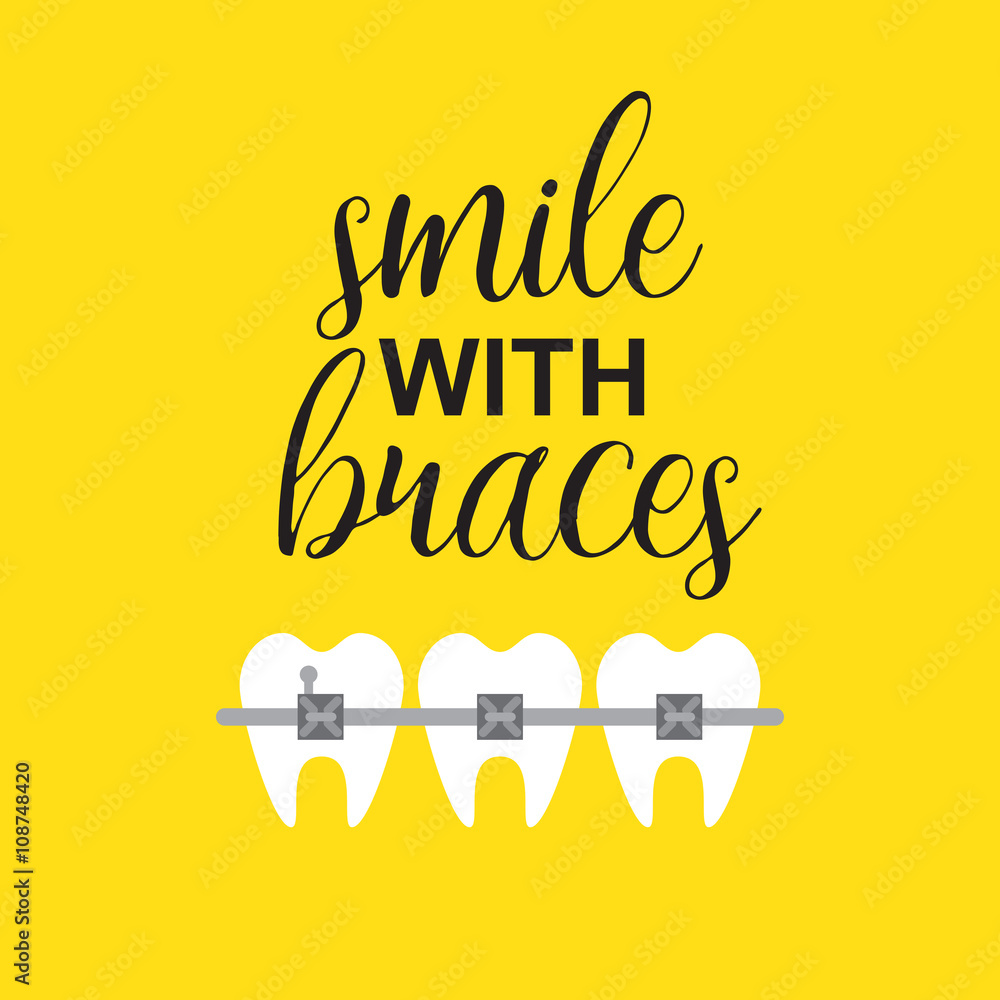 Smile with braces on teeth vector illustration Stock Vector | Adobe Stock