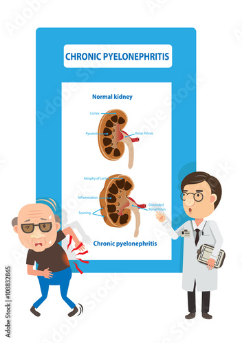 chronic kidney disease/Patients and doctors Viewing diagrams kidney failure. Vector illustration.