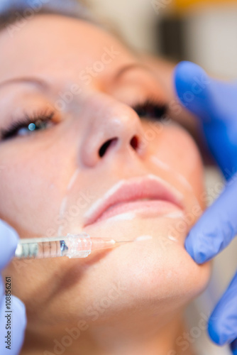 Collagen injection