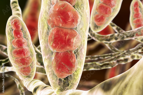 Fungus Trichophyton mentagrophytes. Macroconidia (multi-celled bodies) and hyphae (filamentous structures), 3D illustration. Causes athlete's foot (Tinea pedis) and scalp ringworm (Tinea capitus) photo