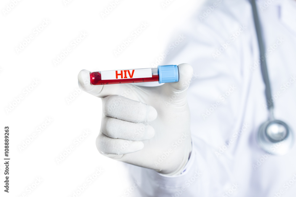 Doctor holding Blood sample with HIV test
Doctor holding Blood sample with HIV test