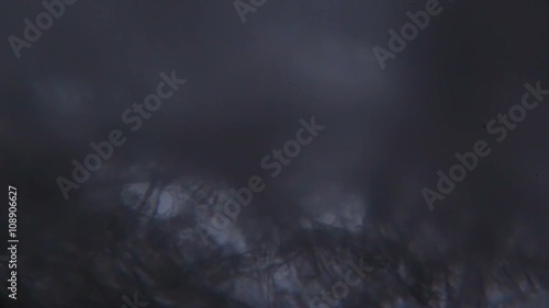 Tissue paper fibers under the microscope.