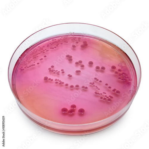 Petri dish with bacteria colonies