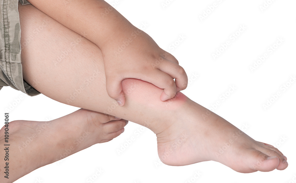 itching leg itching leg