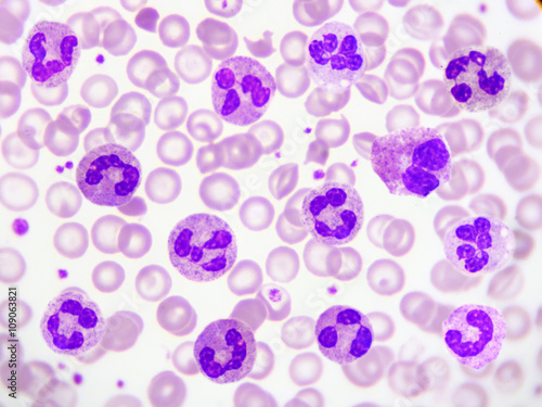 Neutrophil cell in blood smear photo