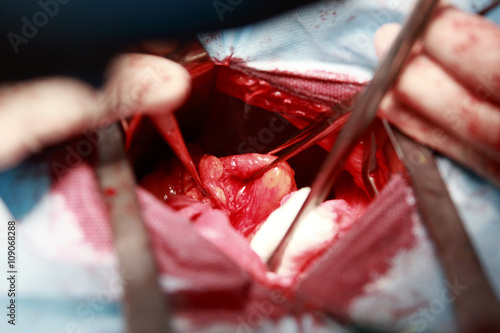 Entrails in Surgery