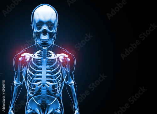 Foto Shoulder Pain 3D illustration.