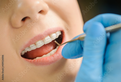 Smiling woman with ceramic braces on teeth at the dental office. Dentist holding iron dental tool. Orthodontic Treatment.