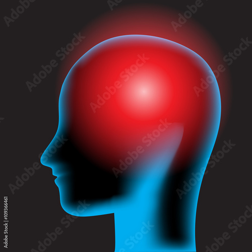 Headache