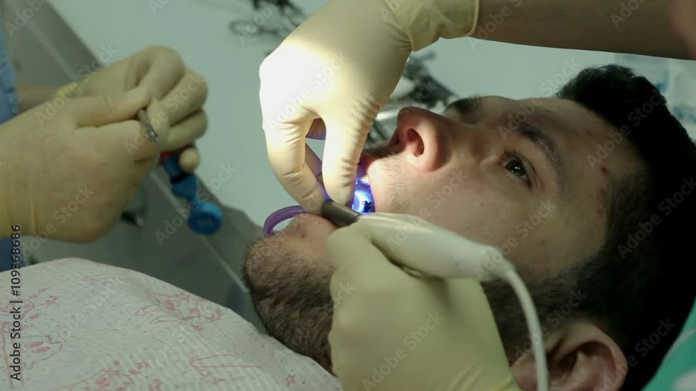 Treatment of caries. Man visits the dentist.