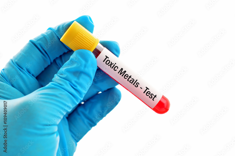 Obraz premium Toxic metals test