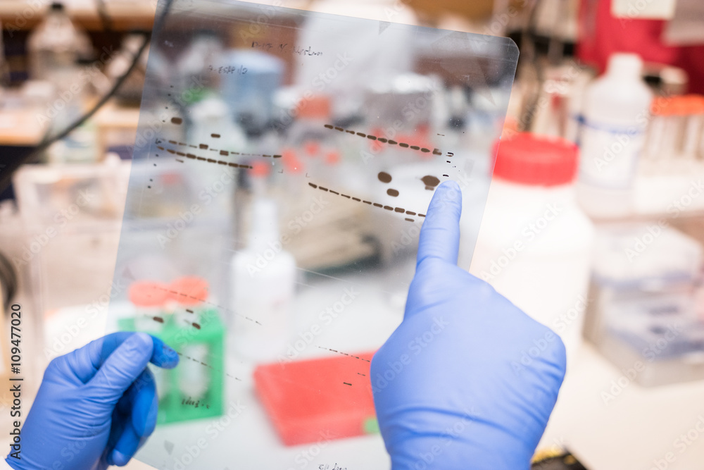 researcher working on gel results researcher working on gel results
