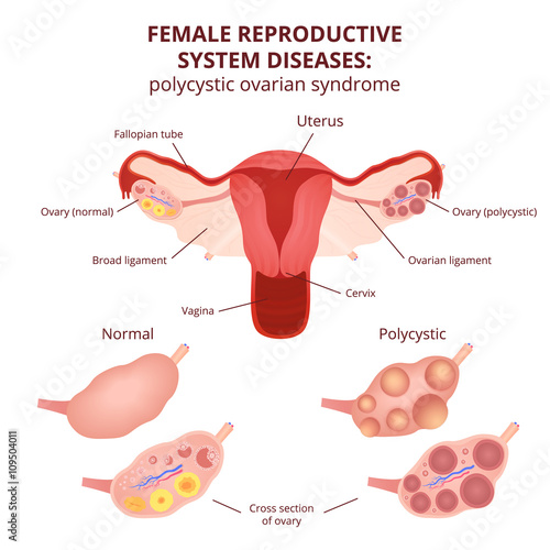female reproductive system photo