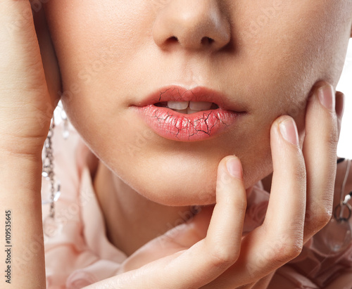 Young woman has chapped lips