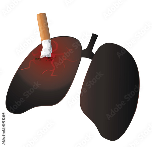 Smoker's lung , No Smoking Concept Vector Illustration