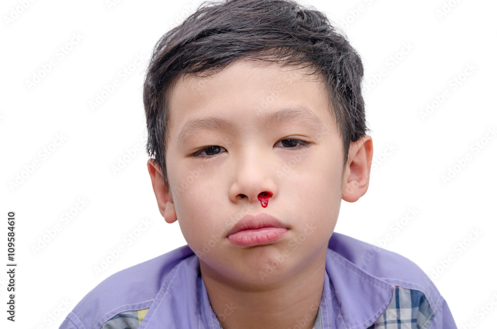 Young Asian boy with bleeding from nose over white Young Asian boy with bleeding from nose over white