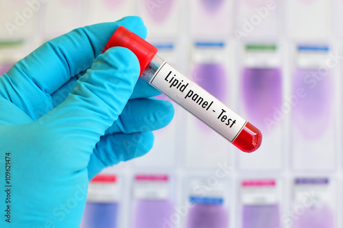 Blood sample for lipid panel test
 photo