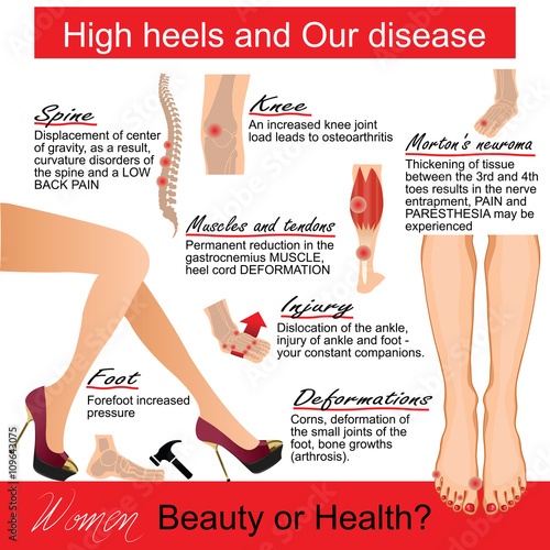 High heels and Our disease. Infografic