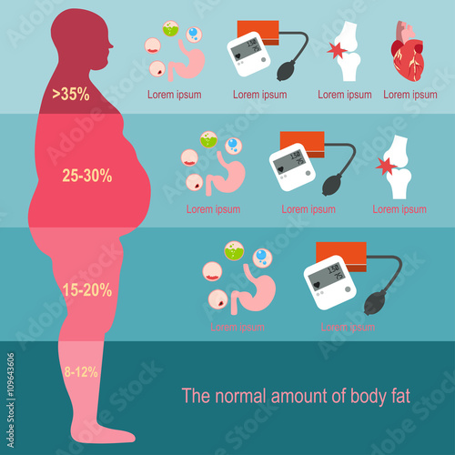 Obesity man. The degree of obesity. Vector illustration. The progression of obesity. Infographics. Body fat percentage from low to high. Diseases from obesity. Flat design.