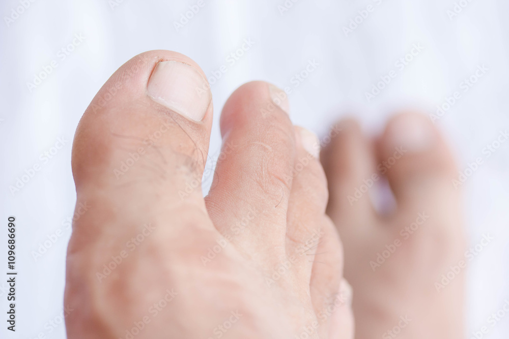 toenail toenail