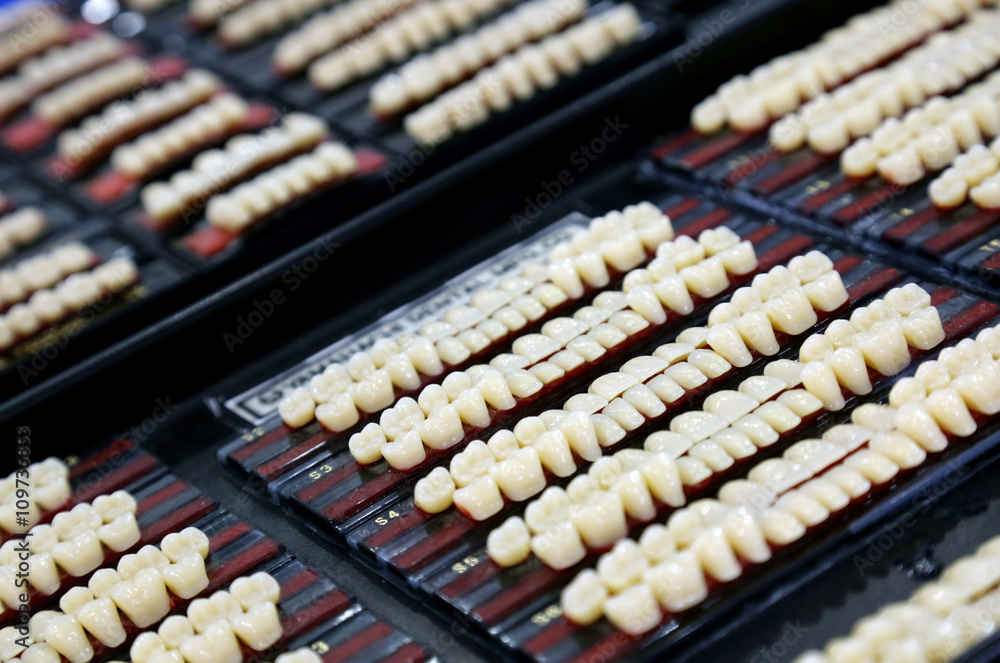 Samples of crowns for dental prostheses Samples of crowns for dental prostheses