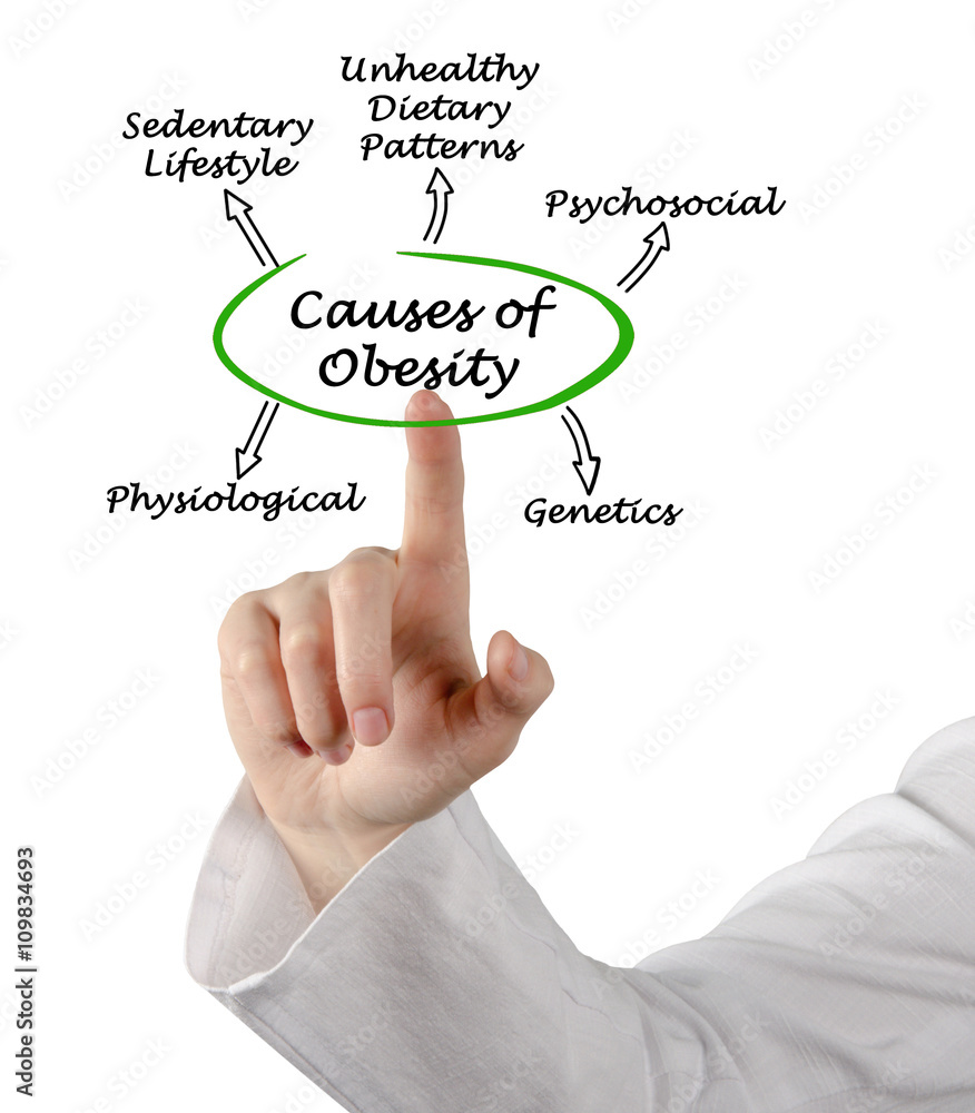 Causes of Obesity