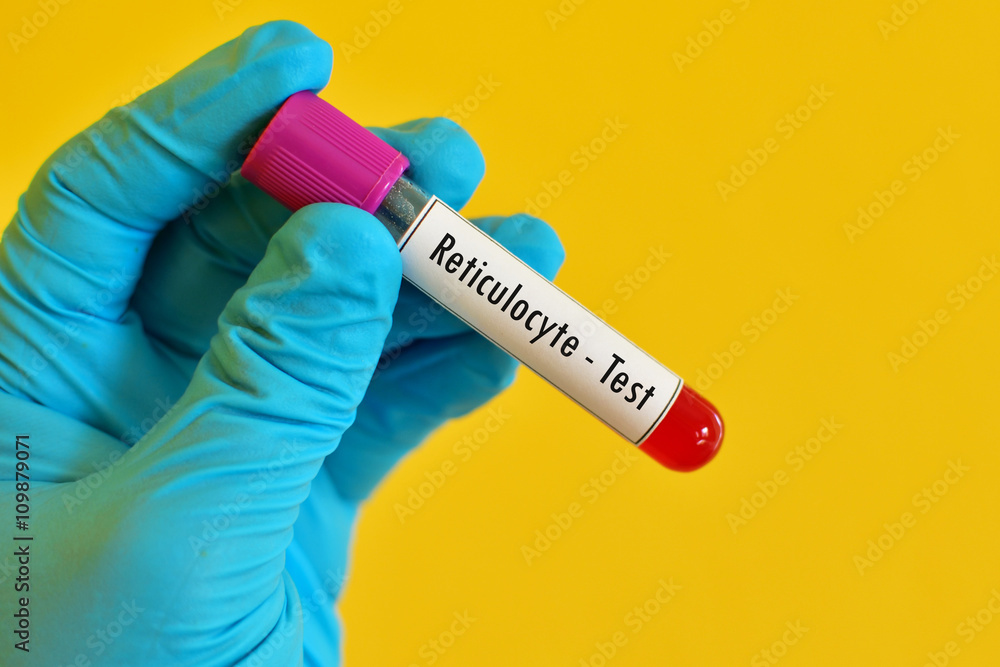 Fototapeta premium Blood sample for reticulocyte count, immature red blood cell analysis