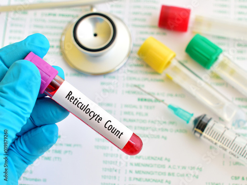 Blood sample for reticulocyte count, immature red blood cell analysis
 photo