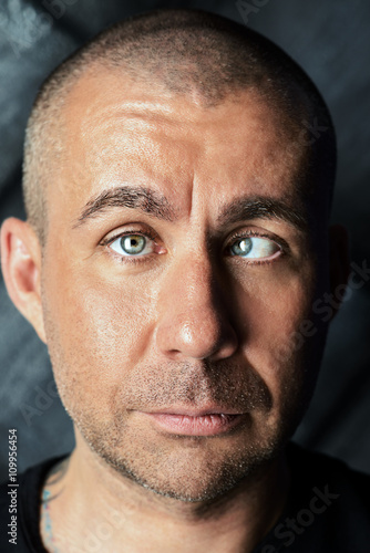 Fotografi strabismus