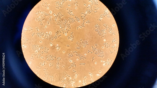 Cancer cell culture/ View through the microscope of a culture of a cancer cell line photo